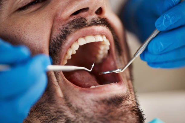 Dental Bonding in Angustura, NM